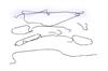 PIPE KIT-BRK - image 1
