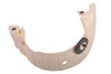 BAFFLE-FRT DIFF (99) - image 2