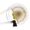 FG1411 Fuel Pump Module Assembly - image 4