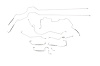 BU1053-SS Complete Brake Line Kit for 1997-2005 Buick Century, Regal [With ABS and Rear Disc Brakes] - image 1