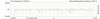 689-200-13 FSL Series Hydraulic Roller Cam for 2007-2015 GM Gen IV LS Engines w/VVT & AFM [Single-Bolt] - image 4
