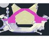 Mid-Mount Motor Plate for Select 1978-1988 Buick, Chevy, Oldsmobile, Pontiac Cars w/GM Gen III LS Engine - image 2