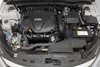 FIPK KIA OPTIMA/HYUNDAI SONATA 2.4L 2013-2014 - image 4