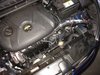 Black SP Cold Air Intake System, 2011-2017 Hyundai Elantra 1.8L - image 2