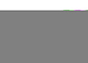 W13327 Steering Rack and Pinion Mount Bushing Kit Fits Select Dodge Models - image 1
